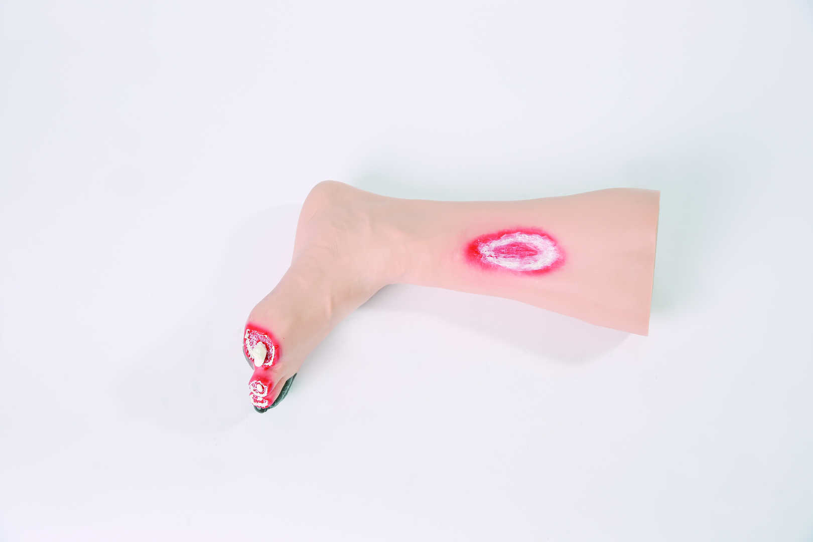 Diabetic Foot Trainer