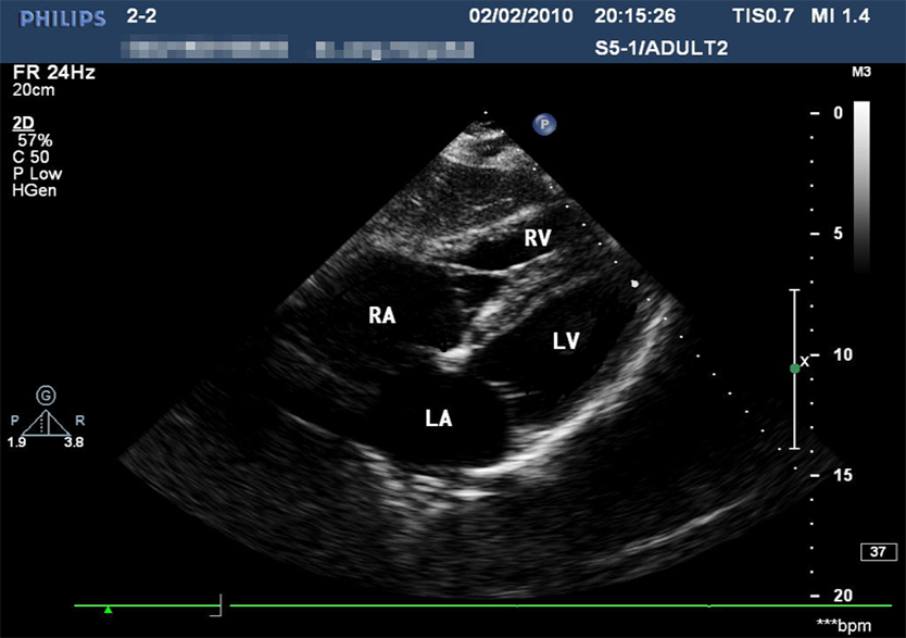 創(chuàng  )傷超聲重點(diǎn)評估平臺2.0