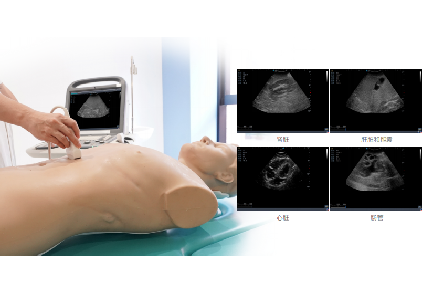 創(chuàng  )傷超聲重點(diǎn)評估平臺 2.0